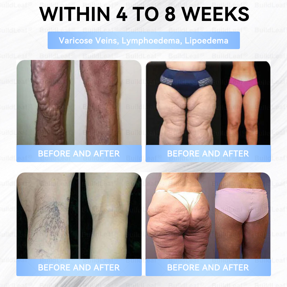 C US 🏥FDA Store |𝐵uil𝗱𝐿ea𝐟® 𝑮𝐋𝑃-1 Slim & Firm 𝑁ano 𝑀icroneedle 𝑃atch with Collagen,Turmeric&Matrixyl 3000 丨Obesity,Cardiovascular Diseas, Diabetes, Sleep Apnea, Joint Problems and More