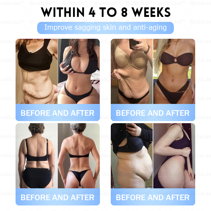 C US 🏥FDA Store |𝐵uil𝗱𝐿ea𝐟® 𝑮𝐋𝑃-1 Slim & Firm 𝑁ano 𝑀icroneedle 𝑃atch with Collagen,Turmeric&Matrixyl 3000 丨Obesity,Cardiovascular Diseas, Diabetes, Sleep Apnea, Joint Problems and More