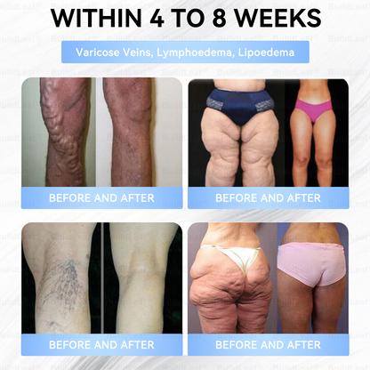 C US 🏥FDA Store |𝐵uil𝗱𝐿ea𝐟® 𝑮𝐋𝑃-1 Slim & Firm 𝑁ano 𝑀icroneedle 𝑃atch with Collagen,Turmeric&Matrixyl 3000 丨Obesity,Cardiovascular Diseas, Diabetes, Sleep Apnea, Joint Problems and More