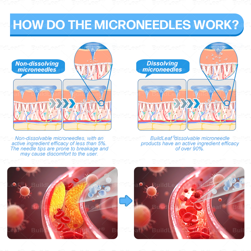 C US 🏥FDA Store |𝐵uil𝗱𝐿ea𝐟® 𝑮𝐋𝑃-1 Slim & Firm 𝑁ano 𝑀icroneedle 𝑃atch with Collagen,Turmeric&Matrixyl 3000 丨Obesity,Cardiovascular Diseas, Diabetes, Sleep Apnea, Joint Problems and More