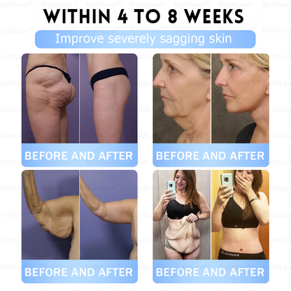 C US 🏥FDA Store |𝐵uil𝗱𝐿ea𝐟® 𝑮𝐋𝑃-1 Slim & Firm 𝑁ano 𝑀icroneedle 𝑃atch with Collagen,Turmeric&Matrixyl 3000 丨Obesity,Cardiovascular Diseas, Diabetes, Sleep Apnea, Joint Problems and More